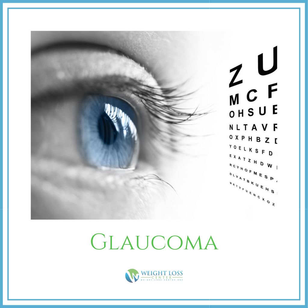 What is Glaucoma?