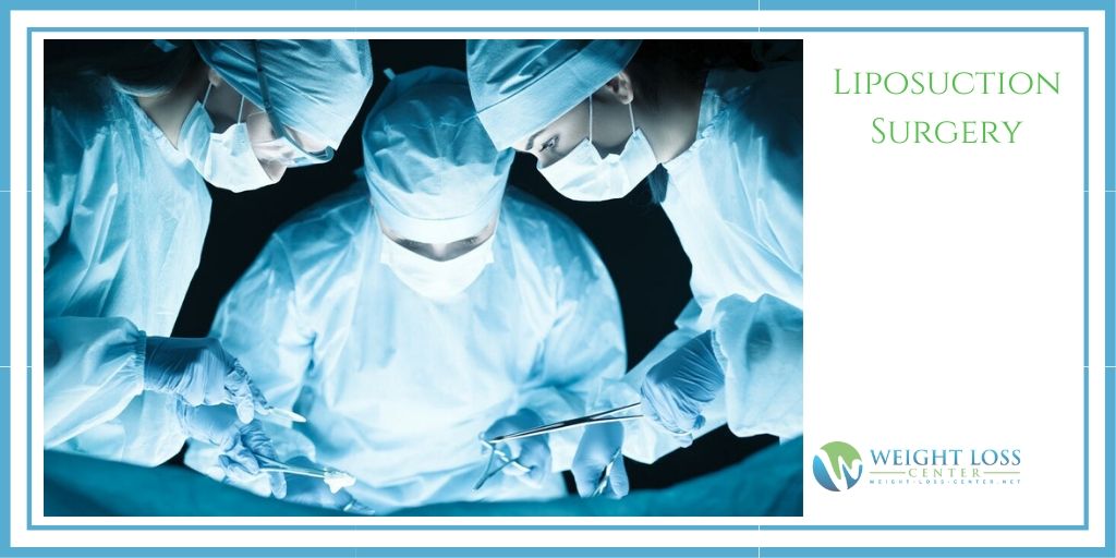 Liposuction Surgery