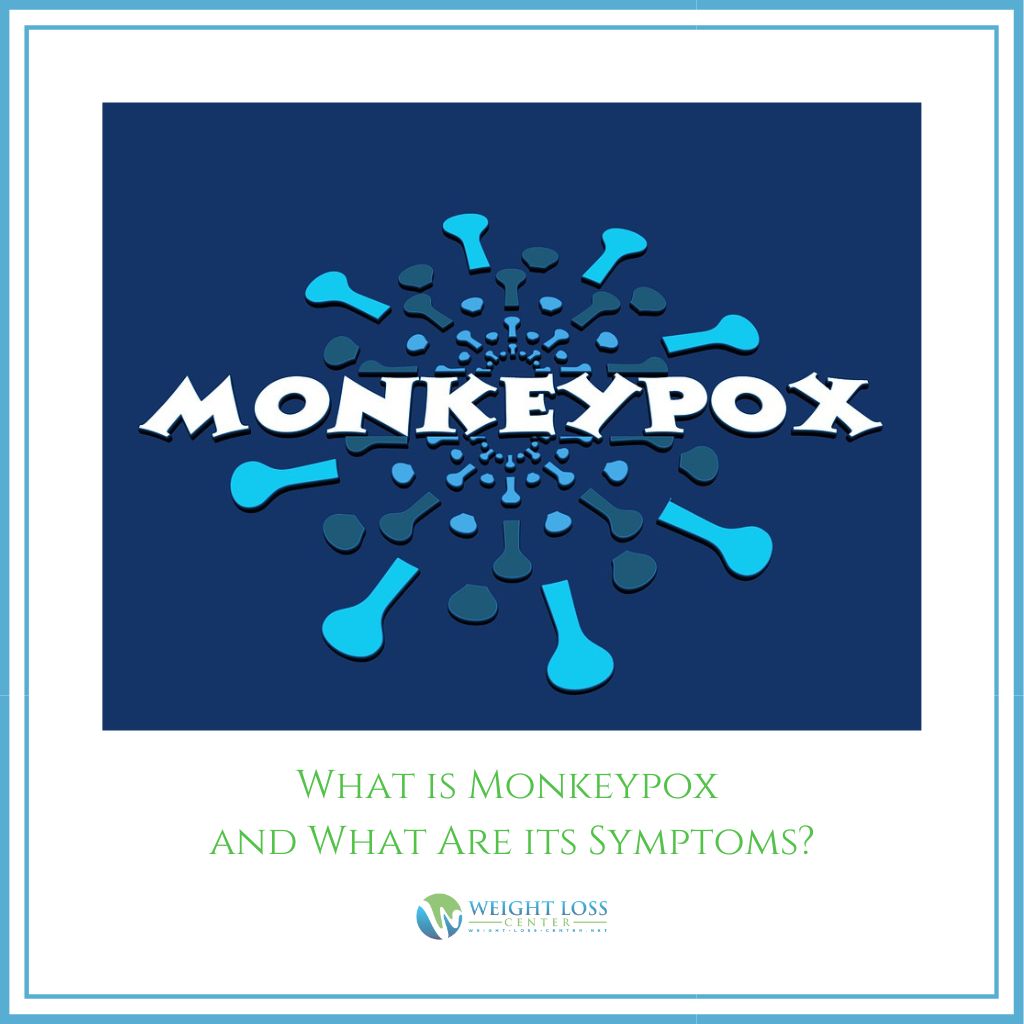 What is Monkeypox and Symptoms