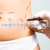 You should careful consider all weight loss surgery health risks before deciding to go ahead with surgery.